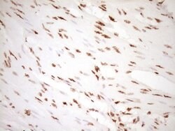 NUDT21 Monoclonal Antibody (OTI5B3), TrueMAB , OriGene 100 &mu;L; Unconjugated:Antibodies,