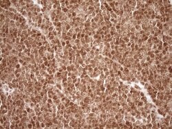 NUDT21 Monoclonal Antibody (OTI5B3), TrueMAB , OriGene 100 &mu;L; Unconjugated:Antibodies,