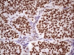 NUDT21 Monoclonal Antibody (OTI13H1), TrueMAB , OriGene 100 &mu;L; Unconjugated:Antibodies,