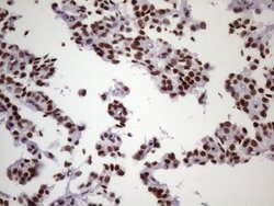 NUDT21 Monoclonal Antibody (OTI13H1), TrueMAB , OriGene 100 &mu;L; Unconjugated:Antibodies,