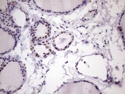 NUDT21 Monoclonal Antibody (OTI13H1), TrueMAB , OriGene 100 &mu;L; Unconjugated:Antibodies,
