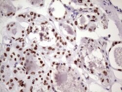 NUDT21 Monoclonal Antibody (OTI13H1), TrueMAB , OriGene 100 &mu;L; Unconjugated:Antibodies,