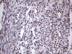 NUDT21 Monoclonal Antibody (OTI13H1), TrueMAB , OriGene 100 &mu;L; Unconjugated:Antibodies,