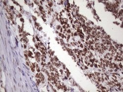 NUDT21 Monoclonal Antibody (OTI13H1), TrueMAB , OriGene 100 &mu;L; Unconjugated:Antibodies,