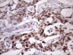 NUDT21 Monoclonal Antibody (OTI13H1), TrueMAB , OriGene 100 &mu;L; Unconjugated:Antibodies,