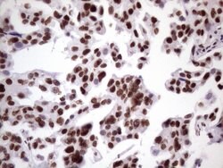 NUDT21 Monoclonal Antibody (OTI13H1), TrueMAB , OriGene 100 &mu;L; Unconjugated:Antibodies,