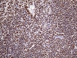 NUDT21 Monoclonal Antibody (OTI13H1), TrueMAB , OriGene 100 &mu;L; Unconjugated:Antibodies,