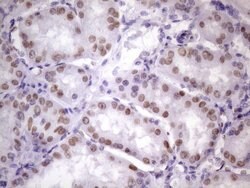 NUDT21 Monoclonal Antibody (OTI13H1), TrueMAB , OriGene 100 &mu;L; Unconjugated:Antibodies,