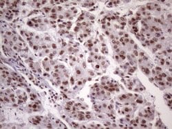 NUDT21 Monoclonal Antibody (OTI13H1), TrueMAB , OriGene 100 &mu;L; Unconjugated:Antibodies,