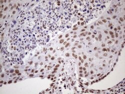 NUDT21 Monoclonal Antibody (OTI1B1), TrueMAB , OriGene 100 &mu;L; Unconjugated:Antibodies,