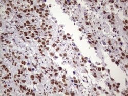 NUDT21 Monoclonal Antibody (OTI1B1), TrueMAB , OriGene 100 &mu;L; Unconjugated:Antibodies,