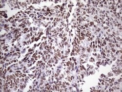 NUDT21 Monoclonal Antibody (OTI1B1), TrueMAB , OriGene 100 &mu;L; Unconjugated:Antibodies,