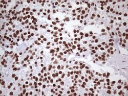 NUDT21 Monoclonal Antibody (OTI1B1), TrueMAB , OriGene 100 &mu;L; Unconjugated:Antibodies,