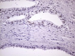 NUDT21 Monoclonal Antibody (OTI1B1), TrueMAB , OriGene:Antibodies:Primary