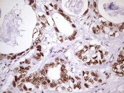 NUDT21 Monoclonal Antibody (OTI1B1), TrueMAB , OriGene 100 &mu;L; Unconjugated:Antibodies,