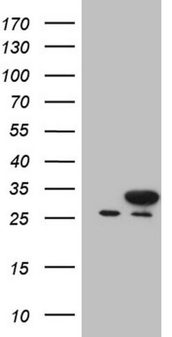 NUDT21 Monoclonal Antibody (OTI5B3), TrueMAB , OriGene 100 &mu;L; Unconjugated:Antibodies,