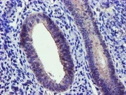 NUDT6 Monoclonal Antibody (OTI7F4), TrueMAB , OriGene 100 &mu;L; Unconjugated:Antibodies,
