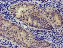 NUDT6 Monoclonal Antibody (OTI7F4), TrueMAB , OriGene 100 &mu;L; Unconjugated:Antibodies,