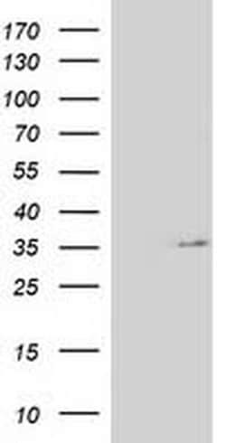 NUDT6 Monoclonal Antibody (OTI9F5), TrueMAB , OriGene 30 &mu;L; Unconjugated:Antibodies,