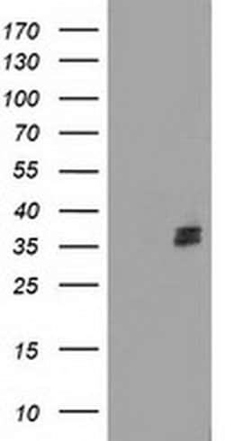 NUDT6 Monoclonal Antibody (OTI9D5), TrueMAB , OriGene 100 &mu;L; Unconjugated:Antibodies,
