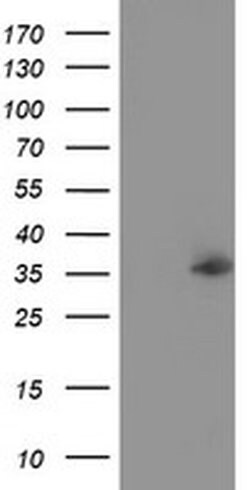 NUDT6 Monoclonal Antibody (OTI7F4), TrueMAB , OriGene 100 &mu;L; Unconjugated:Antibodies,