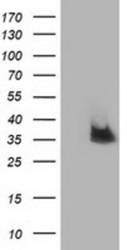 NUDT6 Mouse anti-Human, Clone: OTI10B4, lyophilized, TrueMAB 100 &mu;g;