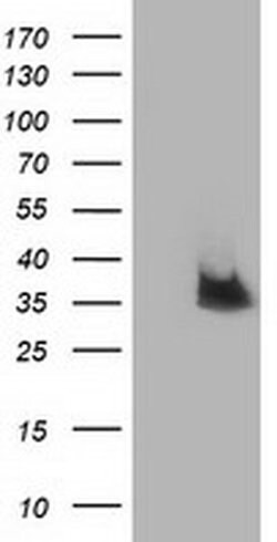 NUDT6 Monoclonal Antibody (OTI10B4), TrueMAB , OriGene 100 &mu;L; Unconjugated:Antibodies,