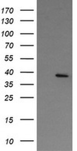 NUDT9 Monoclonal Antibody (OTI 7F12), TrueMAB , OriGene:Antibodies:Primary