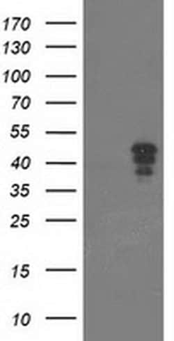 NUDT9 Monoclonal Antibody (OTI5B5), TrueMAB , OriGene 100 &mu;L; Unconjugated:Antibodies,