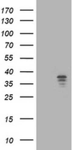 NUDT9 Mouse anti-Human, Clone: OTI7A12, TrueMAB , Origene 30 &mu;L; Unconjugated:Antibodies,