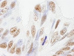 NUMA Polyclonal Antibody, Bethyl Laboratories 100 &mu;L; Unconjugated:Antibodies,