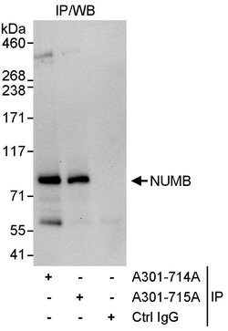 NUMB Rabbit anti-Human, Polyclonal, Bethyl Laboratories 10 &mu;L; Unconjugated:Antibodies,