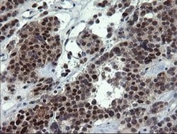 NUMB Mouse anti-Human, Clone: OTI5A9, liquid, TrueMAB 100 &mu;L; Unconjugated:Antibodies,
