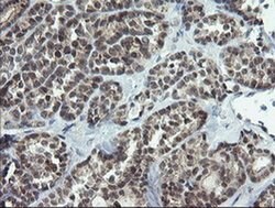 NUMB Mouse anti-Human, Clone: OTI5A9, liquid, TrueMAB 100 &mu;L; Unconjugated:Antibodies,