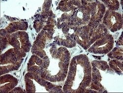NUMB Mouse anti-Human, Clone: OTI5A9, liquid, TrueMAB 100 &mu;L; Unconjugated:Antibodies,