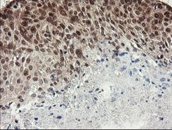NUMB Monoclonal Antibody (OTI4F3), TrueMAB , OriGene 100 &mu;L; Unconjugated:Antibodies,