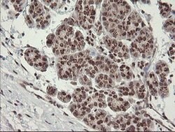 NUMB Monoclonal Antibody (OTI4F3), TrueMAB , OriGene 100 &mu;L; Unconjugated:Antibodies,