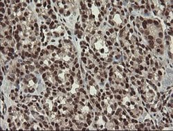 NUMB Monoclonal Antibody (OTI4F3), TrueMAB , OriGene 100 &mu;L; Unconjugated:Antibodies,