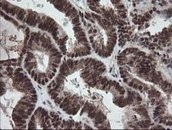 NUMB Monoclonal Antibody (OTI4F3), TrueMAB , OriGene:Antibodies:Primary