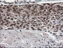NUMB Monoclonal Antibody (OTI4F3), TrueMAB , OriGene 100 &mu;L; Unconjugated:Antibodies,