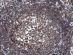 NUMB Monoclonal Antibody (OTI4F3), TrueMAB , OriGene 100 &mu;L; Unconjugated:Antibodies,