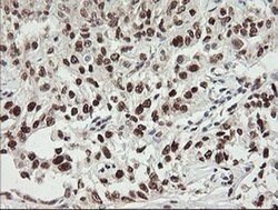 NUMB Monoclonal Antibody (OTI4F3), TrueMAB , OriGene 100 &mu;L; Unconjugated:Antibodies,