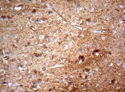 NUMB Mouse anti-Human, Clone: OTI2B9, lyophilized, TrueMAB 100 &mu;g; Unconjugated:Antibodies,