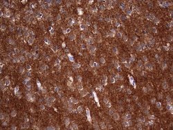 NUMB Monoclonal Antibody (OTI1B5), TrueMAB , OriGene 100 &mu;L; Unconjugated:Antibodies,