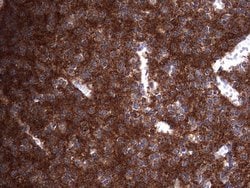 NUMB Monoclonal Antibody (OTI1B5), TrueMAB , OriGene 100 &mu;L; Unconjugated:Antibodies,