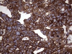 NUMB Monoclonal Antibody (OTI1B5), TrueMAB , OriGene 100 &mu;L; Unconjugated:Antibodies,