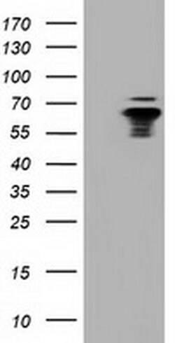 NUMB Monoclonal Antibody (OTI6B2), TrueMAB , OriGene:Antibodies:Primary