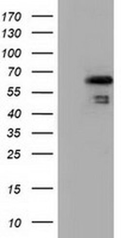 NUMB Monoclonal Antibody (OTI1A7), TrueMAB , OriGene 100 &mu;L; Unconjugated:Antibodies,