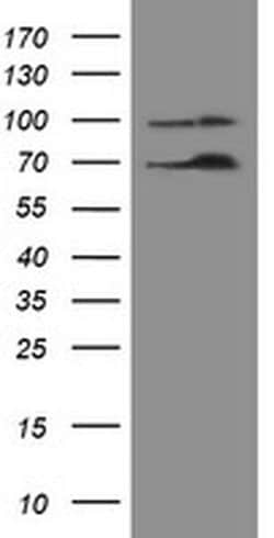 NUMB Monoclonal Antibody (OTI4F3), TrueMAB , OriGene 100 &mu;L; Unconjugated:Antibodies,