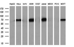 NUMB Monoclonal Antibody (OTI4F3), TrueMAB , OriGene 100 &mu;L; Unconjugated:Antibodies,